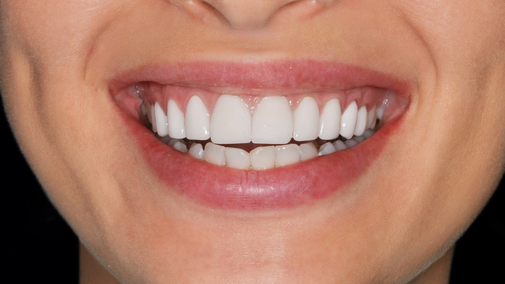 Understanding Periodontal Disease: Information for Healthy Gums, image size:1920x1081